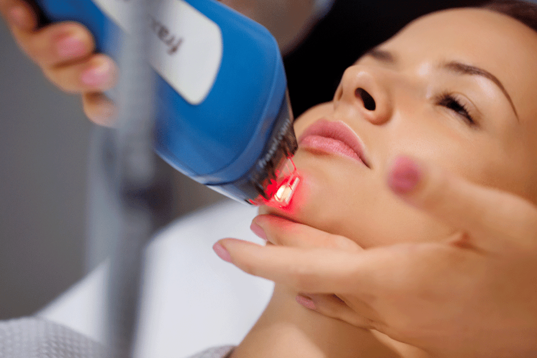 Laser facial skin rejuvenation